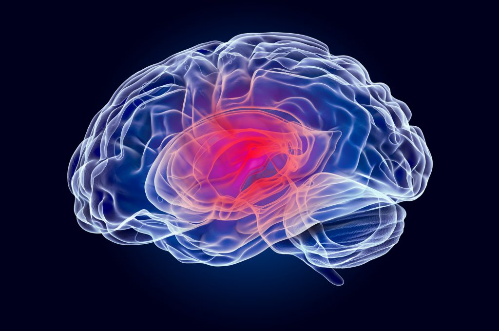 Conozca Los Aspectos B Sicos Sobre Algunas De Las Lesiones Cerebrales